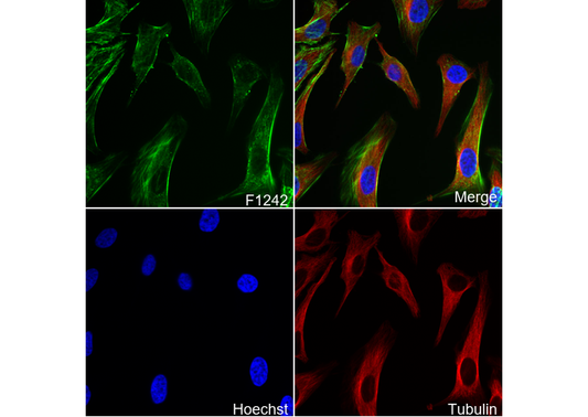 Phospho-Myosin Light Chain 2 (Thr18/Ser19) Antibody