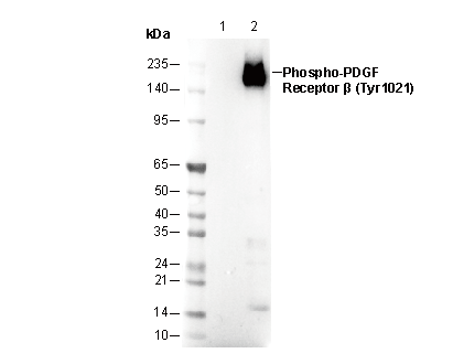 Phospho-PDGF Receptor β (Tyr1021) Antibody