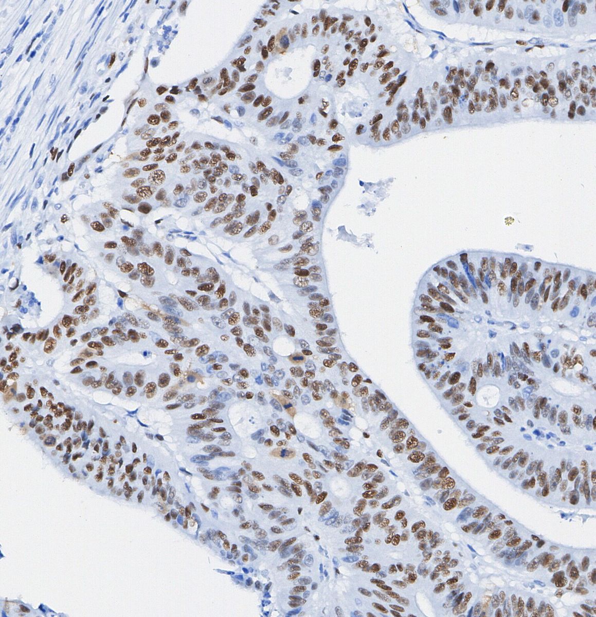 SMARCB1/BAF47 Antibody