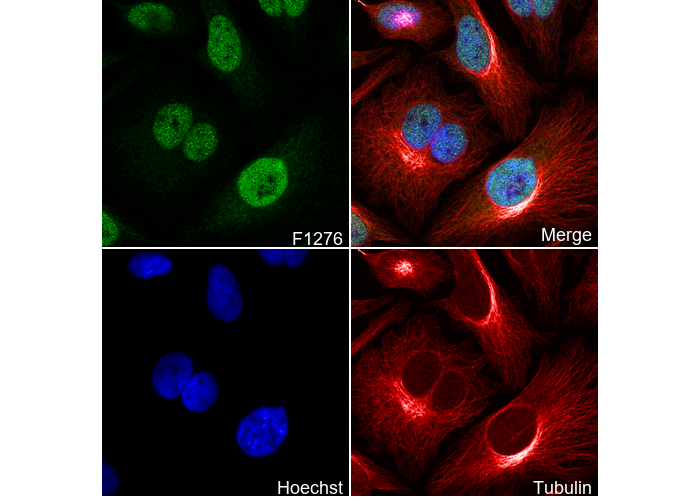CHAF1A Antibody