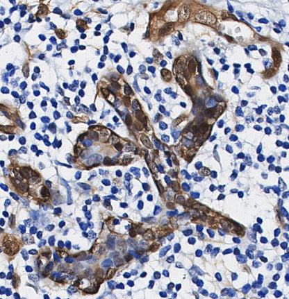 CNOT6 Antibody