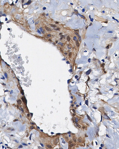 Galectin-9 Antibody