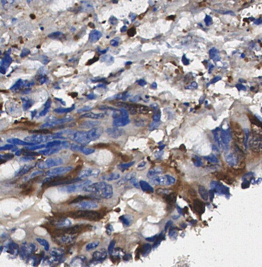 RAGE 1 Antibody