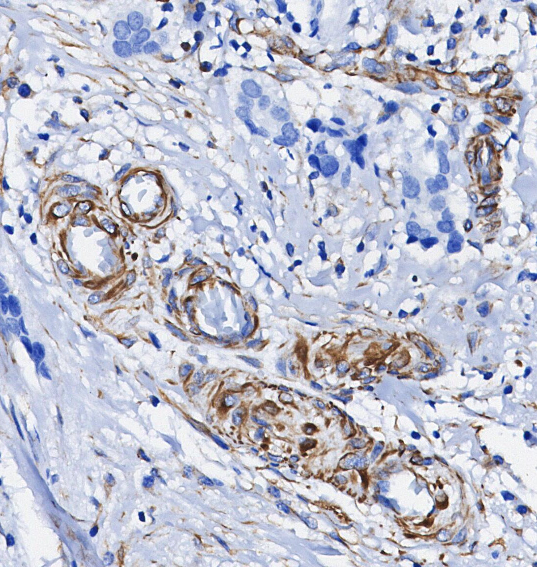 Talin-1 Antibody