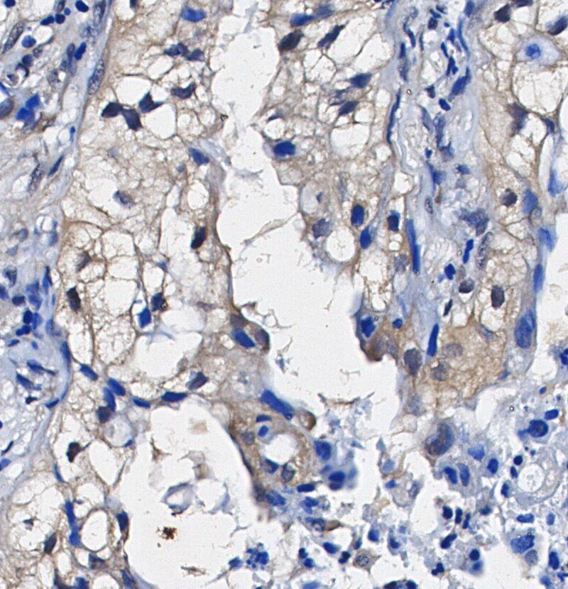 VAMP2 Antibody