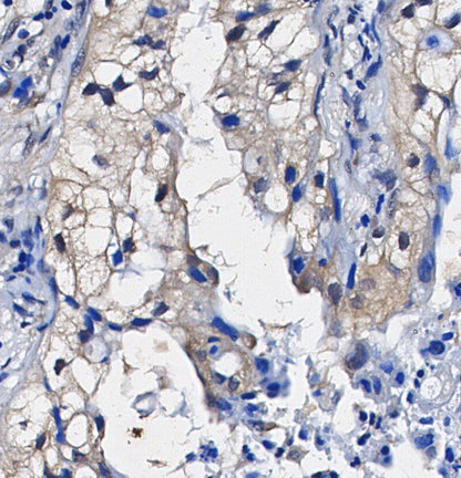 VAMP2 Antibody