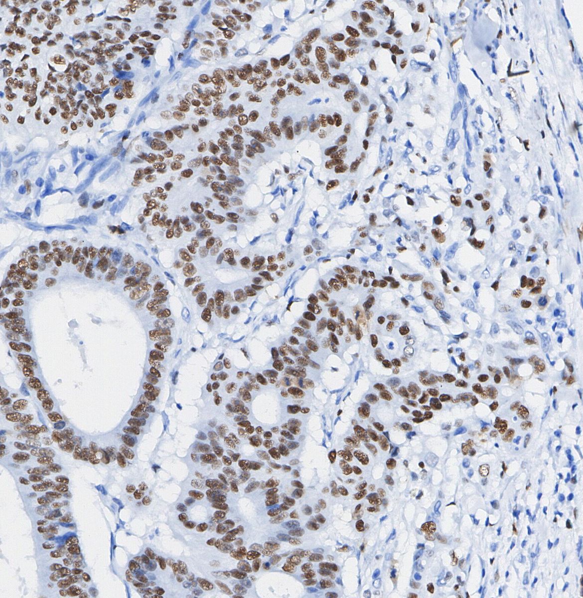 ADAR1 Antibody