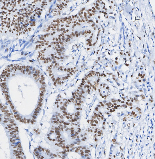 ADAR1 Antibody