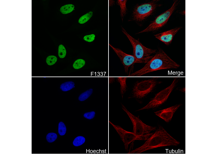 Histone H1.4 Antibody