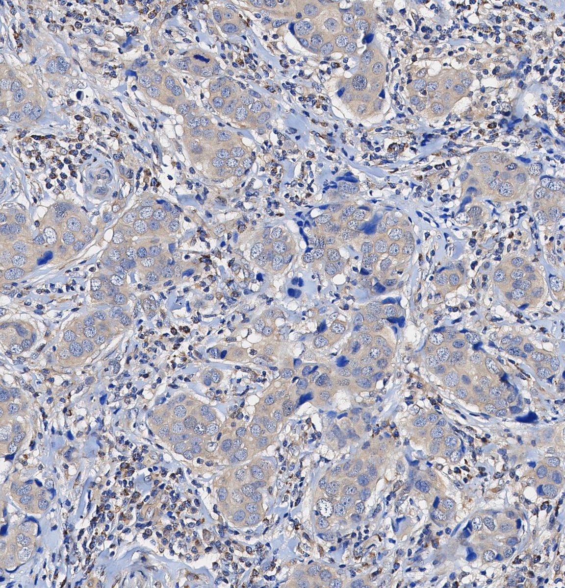 Grp94 Antibody