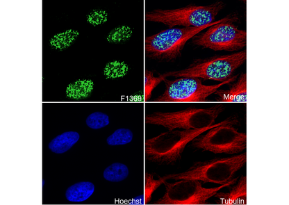 MSH2 Antibody