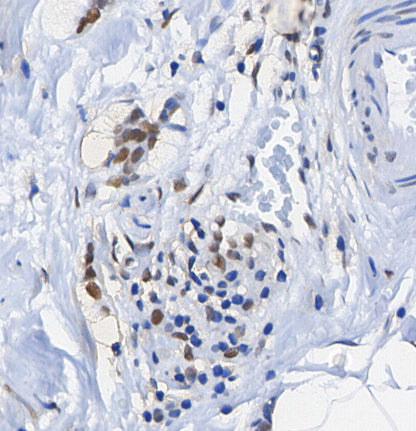 MSH2 Antibody