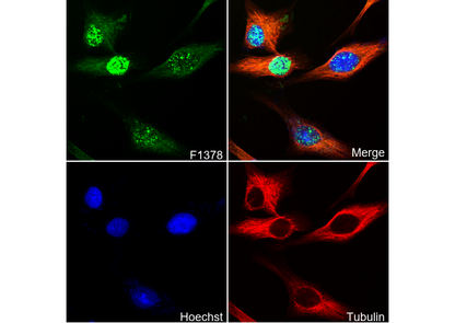 Phospho-SMC1 (Ser957) Antibody