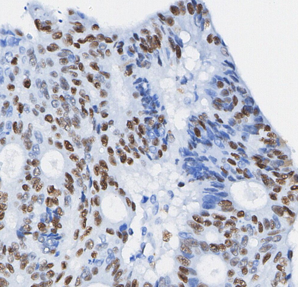 HSF1 Antibody