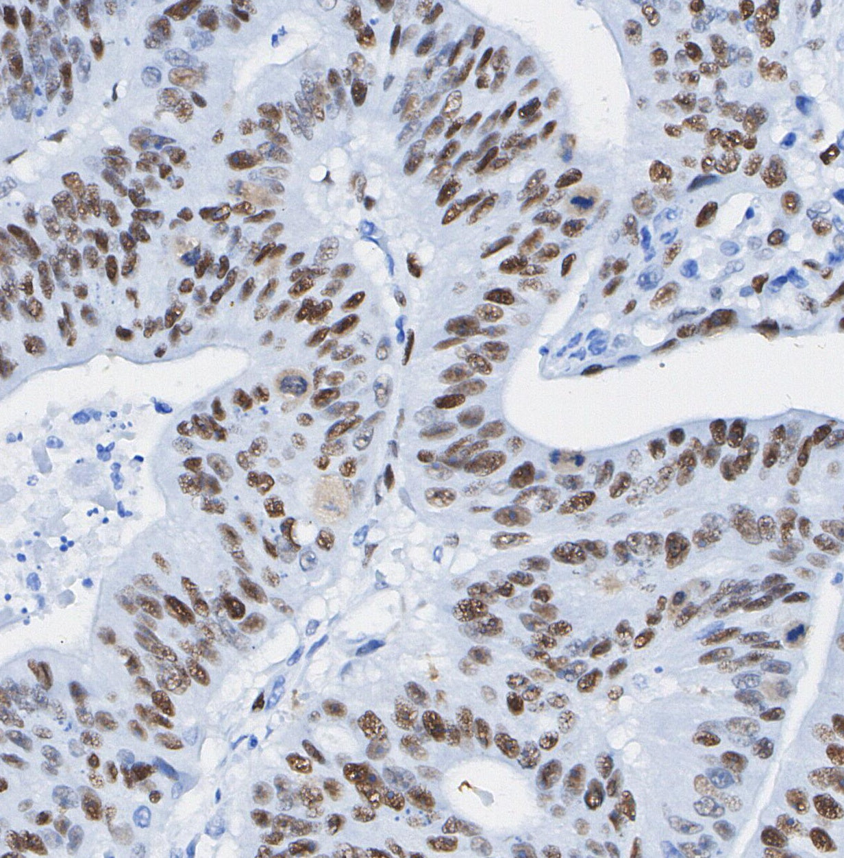 METTL14 Antibody