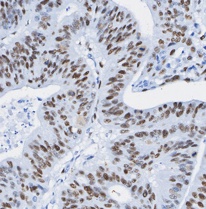 METTL14 Antibody