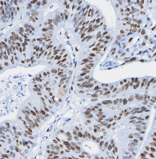METTL14 Antibody