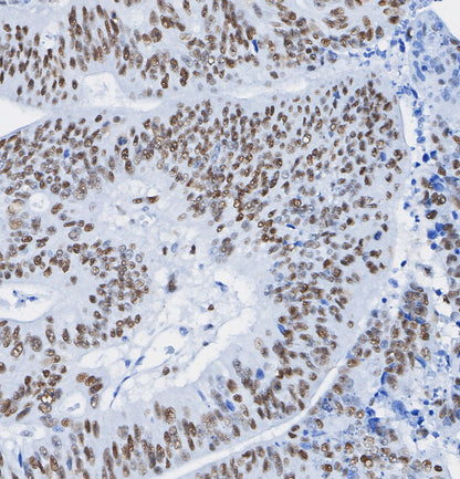 SS18 Antibody