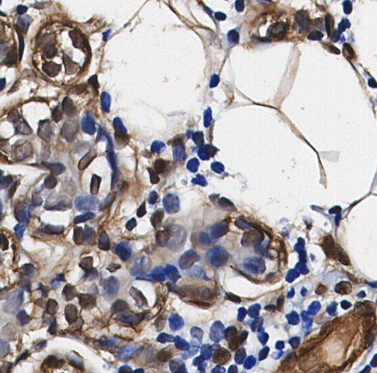 RPL11 Antibody