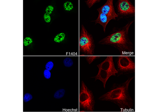 MLL1 C-terminal Antibody