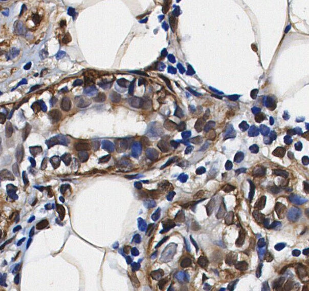 Exportin-1/CRM1 Antibody