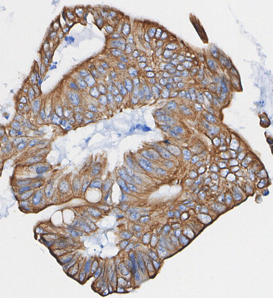 PGRMC1 Antibody