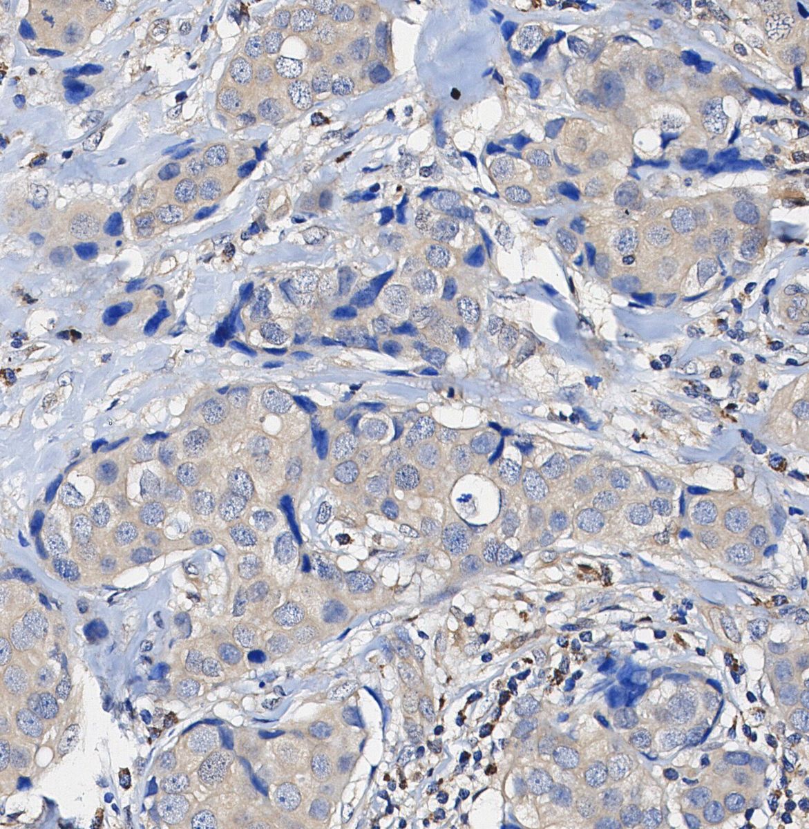 INPP4b Antibody