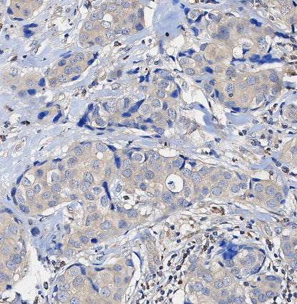 INPP4b Antibody