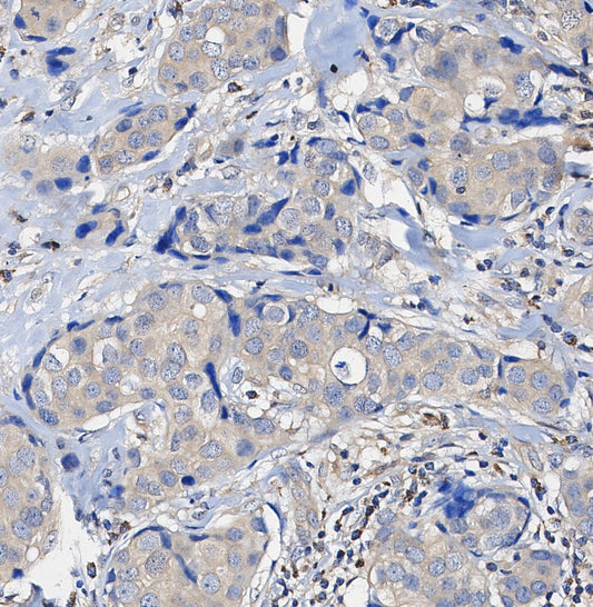 INPP4b Antibody