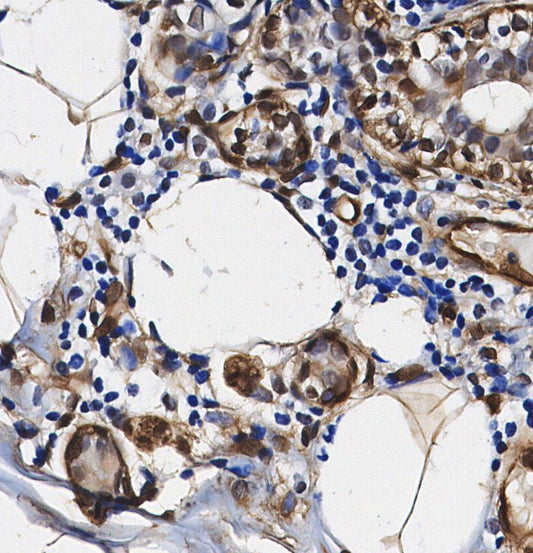 PSMB5 Antibody