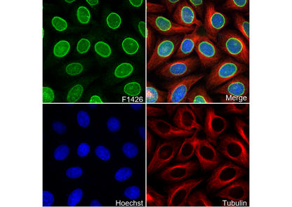 HNF1α Antibody