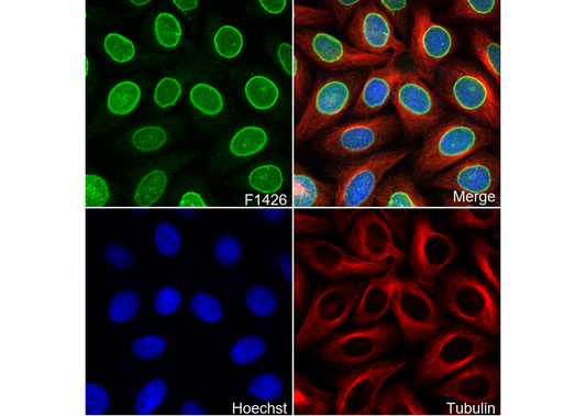 HNF1α Antibody