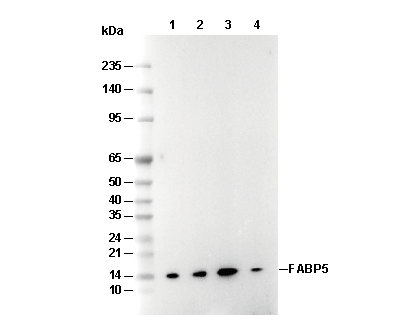 FABP5 Antibody