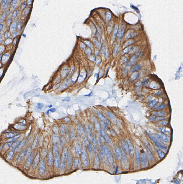 LAMTOR3/MAPKSP1 Antibody