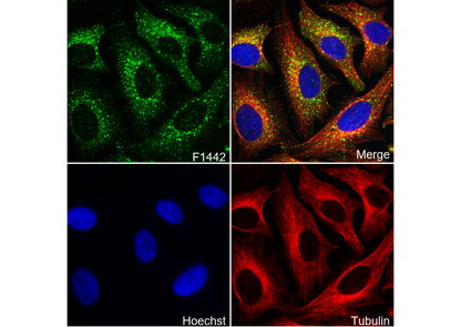 HRS Antibody