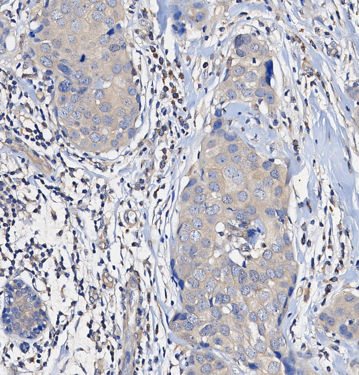 Microcephalin-1/BRIT1 Antibody
