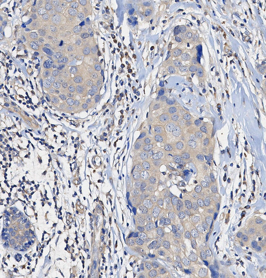 Microcephalin-1/BRIT1 Antibody