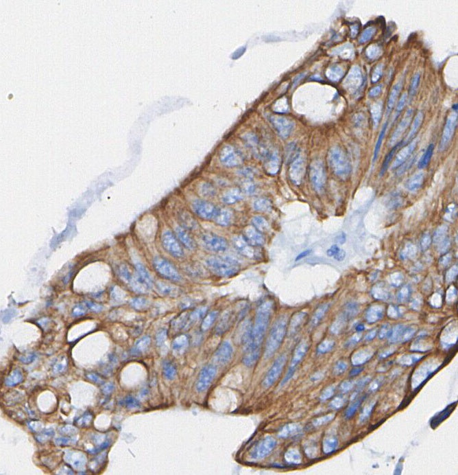 RasGRP3 Antibody