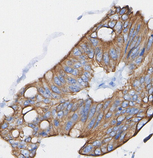 RasGRP3 Antibody