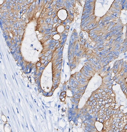 Phospho-IGF-1R β (Tyr980) Antibody