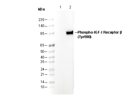 Phospho-IGF-1R β (Tyr980) Antibody