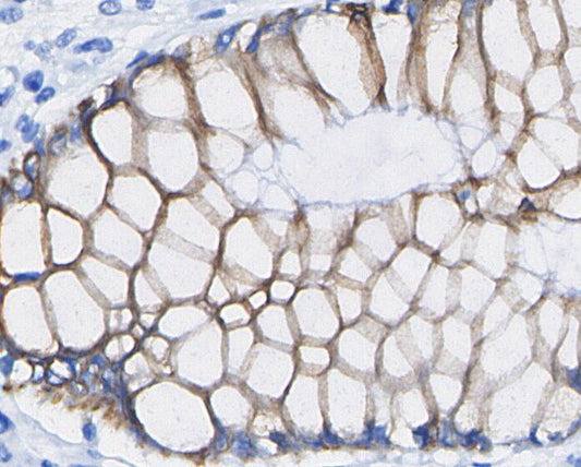 Integrin β4 Antibody