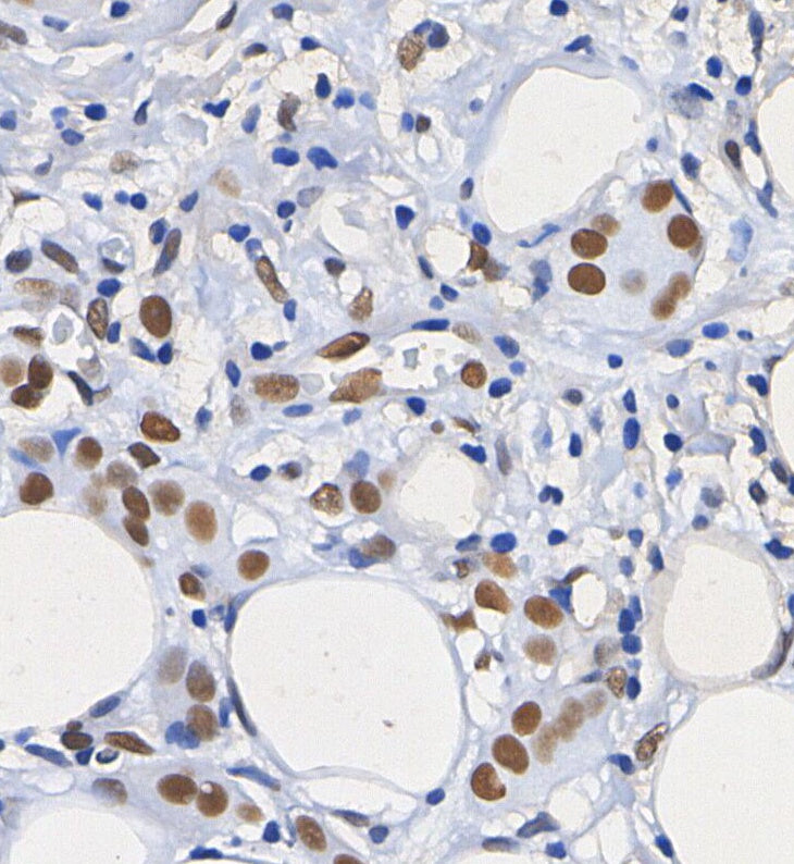 ATF-2 Antibody