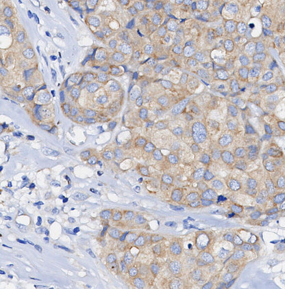 Phospho-SQSTM1/p62 (Ser349) Antibody