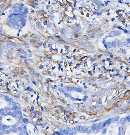 p47phox Antibody