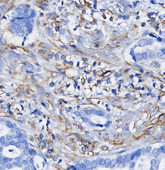 p47phox Antibody