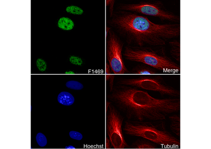 AP-2α Antibody