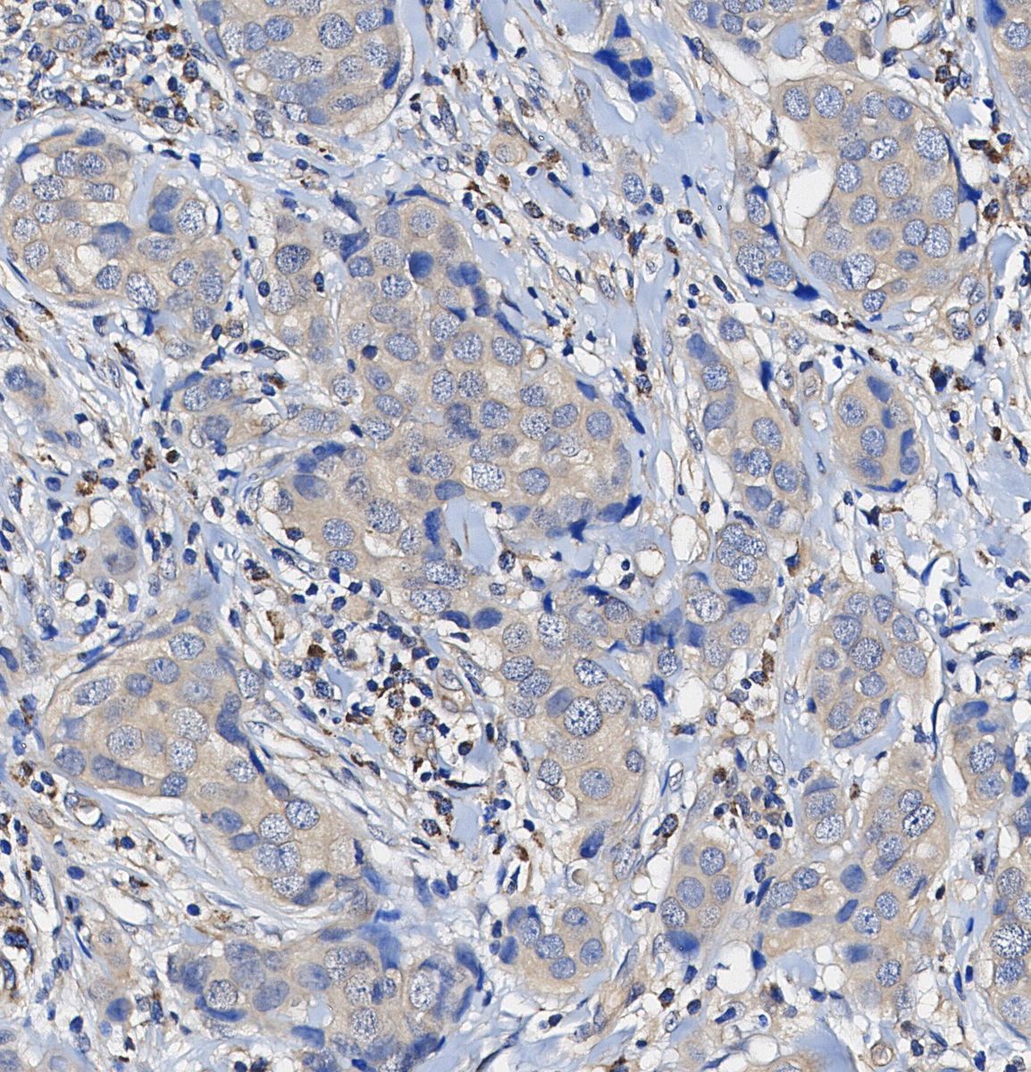 TRAF5 Antibody