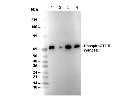 Phospho-TFEB (Ser211) Antibody