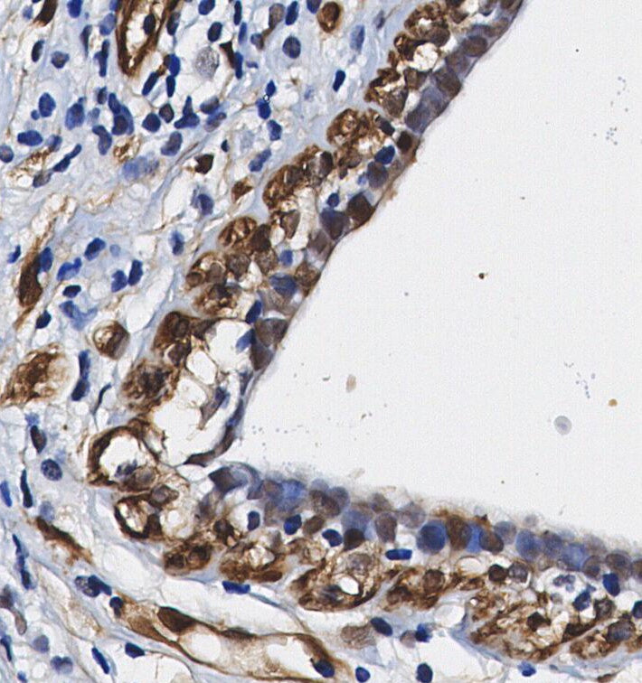 MAPKAPK-5 Antibody